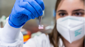 A researcher at the Fralin Biomedical Research Institute holds up a 3-D model of a tumor, created as part of a study to learn how different people’s cancers respond to different therapies. 