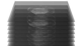 MRI imaging data of a human heart. Photo: JHU