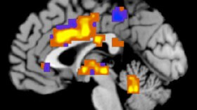 A technique for imaging the brain allowed researchers to distinguish between physical and emotional pain.