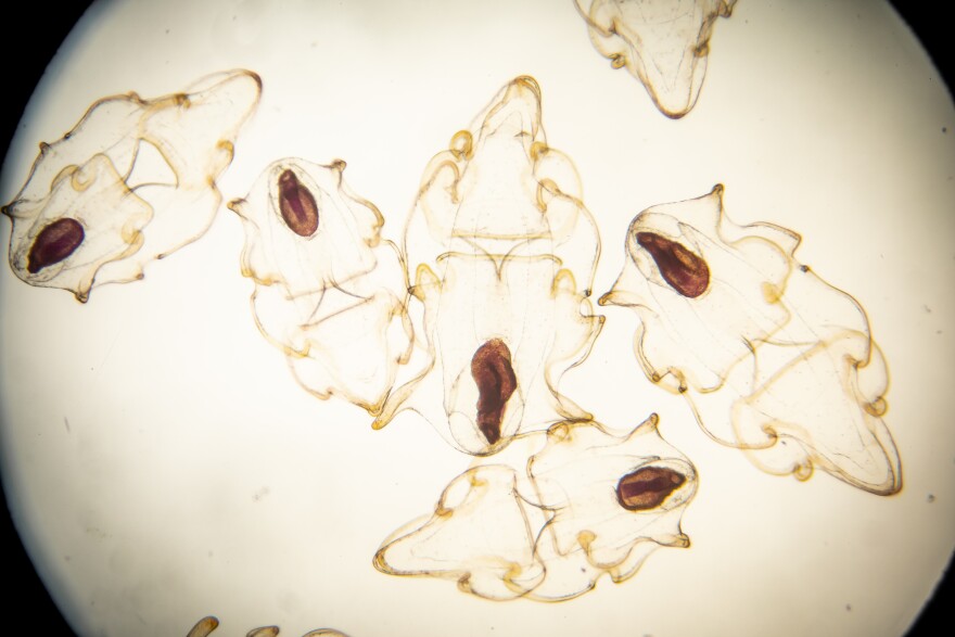 Sunflower sea star larvae, born in mid-January, seen under a microscope. The dark oval shapes are stomachs.