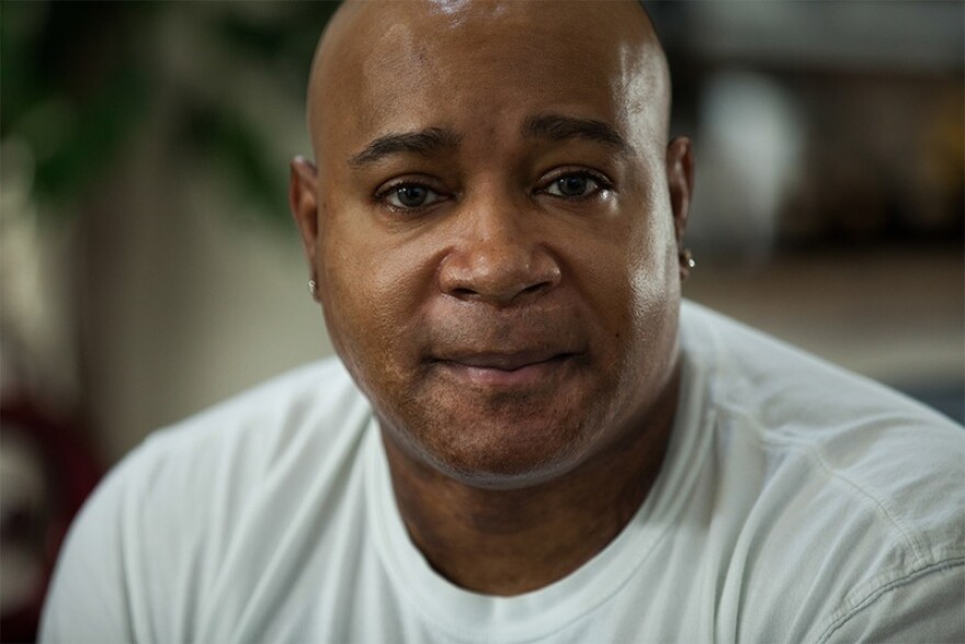 Glenn Johnson, 55, was injured in a smelting accident near Amarillo in 1997 in which a furnace filled with molten metal exploded, crushed him and left major burns over 90 percent of his body. 