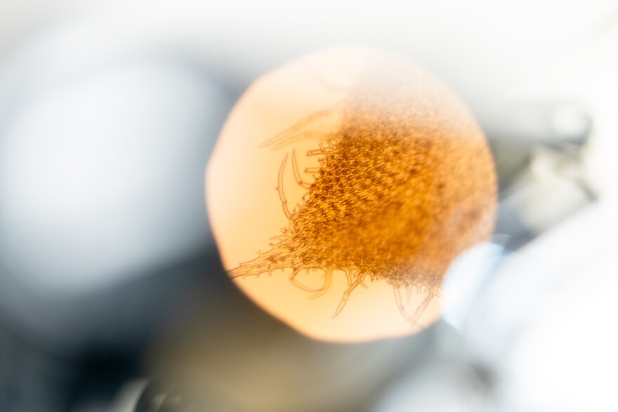 A moss specimen is magnified through a microscope. 