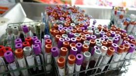 Samples of blood and other bodily fluids at the Marion County Coroner's Office are tested to see if they contain controlled substances.