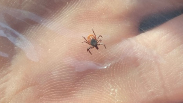 A minute tick is shown sandwiched between layers of packaging tape and held in a person's hand. The eight legs and brown body of the tick are clearly visible, as are the minute ridges of skin that cover the person's palm. the image is captioned "Deer tick sandwiched in tape".