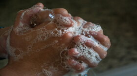 Experts say the most effective way to prevent the spread of the disease is hand-washing.