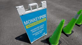 A sign announcing monkeypox vaccination is setup in Tropical Park by Miami-Dade County and Nomi Health in Miami, Florida.
