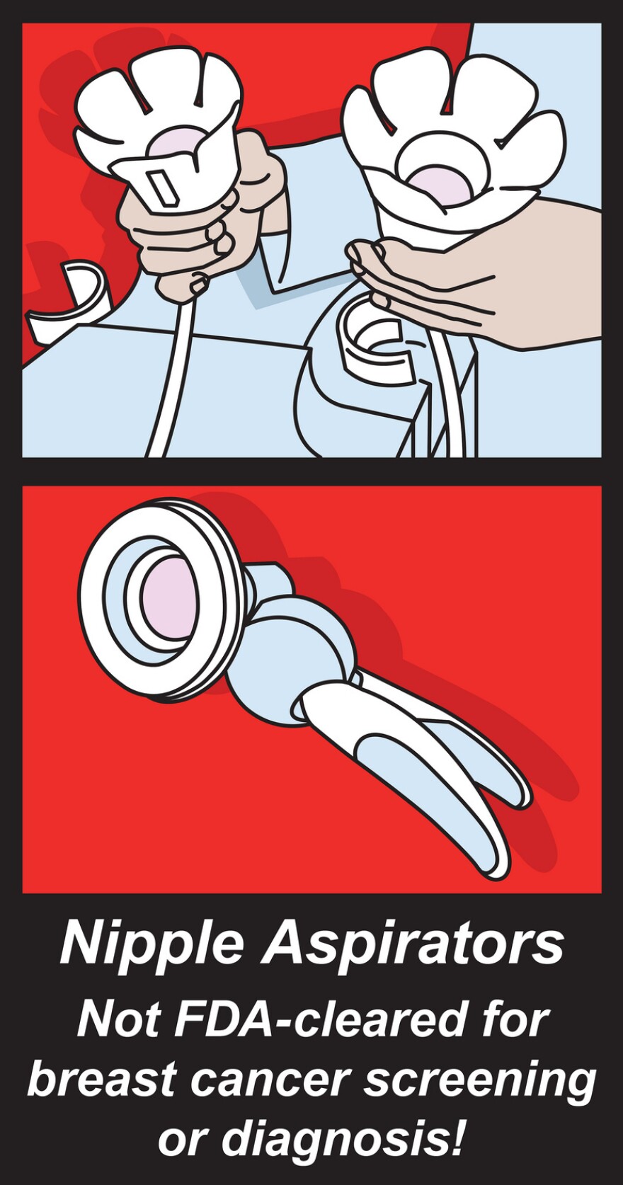 The FDA has not approved nipple aspiration for cancer tests.