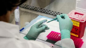 There are several COVID-19 vaccines in late-stage testing.