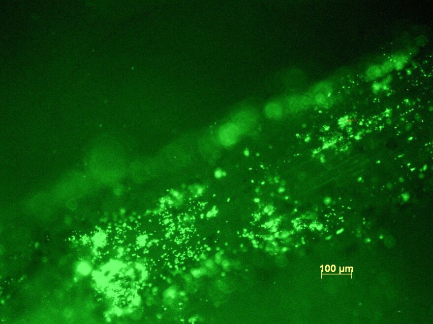 Endophytes are microbes that live inside plants — the ones tagged with a fluorescent dye in this image are found in poplars. The microbes gather nitrogen from the air, turning it into a form plants can use, a process called nitrogen fixation. Researchers are looking at how these microbes could be used to help crops like rice and corn make their own fertilizer.