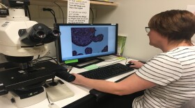 Dr. Helen Jones, in charge of fetal and placental research at Cincinnati Children's, looks at part of a human placenta.