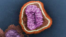 1981 Dr. Erskine. L. Palmer; Dr. M. L. Martin This negative-stained transmission electron micrograph (TEM) depicts the ultrastructural details of an influenza virus particle, or “virion”. T he influenza virus is a single-stranded RNA organism.