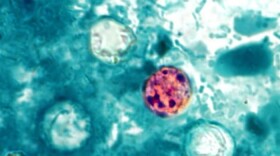 This photo shows four Cyclospora "oocysts" under a microscope. A Kansas woman is suing Taco Bell after she allegedly contracted the parasite from food there.