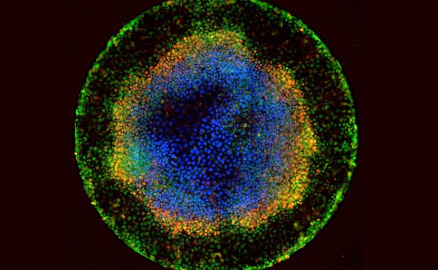 Embryoids like this one are created from stem cells and resemble very primitive human embryos. Scientists hope to use them to learn more about basic human biology and development.