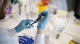  A researcher works on a vaccine against the new coronavirus COVID-19 at the Copenhagen's University research lab in Copenhagen, Denmark, on March 23, 2020. (Thibault Savary/AFP via Getty Images)