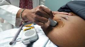A doctor uses a hand-held Doppler probe on a pregnant woman to measure the heartbeat of the fetus. (Rogelio V. Solis/AP)