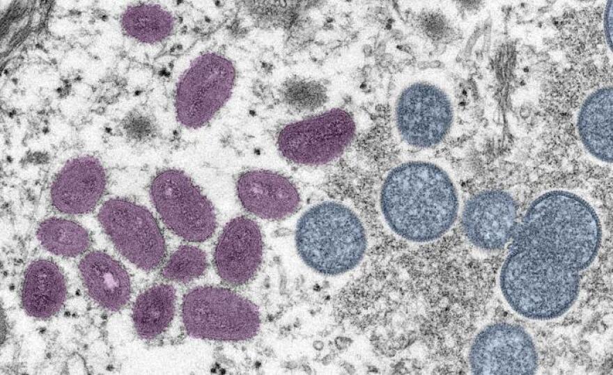 A digitally-colorized electron microscopic image of a monkeypox virion. 