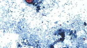 A microscope photo Cyclospora cayetanensis oocysts found in a fresh stool sample 