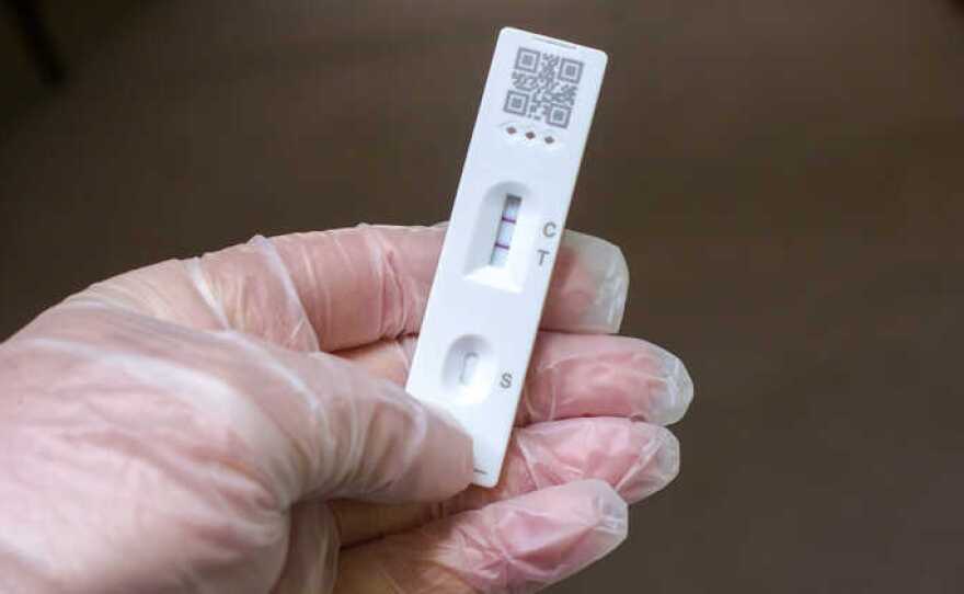 A self-rapid test for COVID-19 Coronavirus