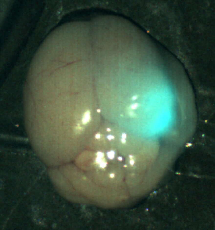 An image of a mouse brain tumor under near-infrared light. The blue-green glow in the upper right quadrant is the tumor, labeled with tumor paint.