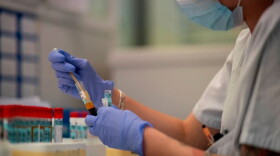 A scientist works at the serology laboratory of the San Carlos Clinic Hospital in Madrid on June 16, 2020. (Pierre-Philippe Marcou/AFP/Getty Images) 