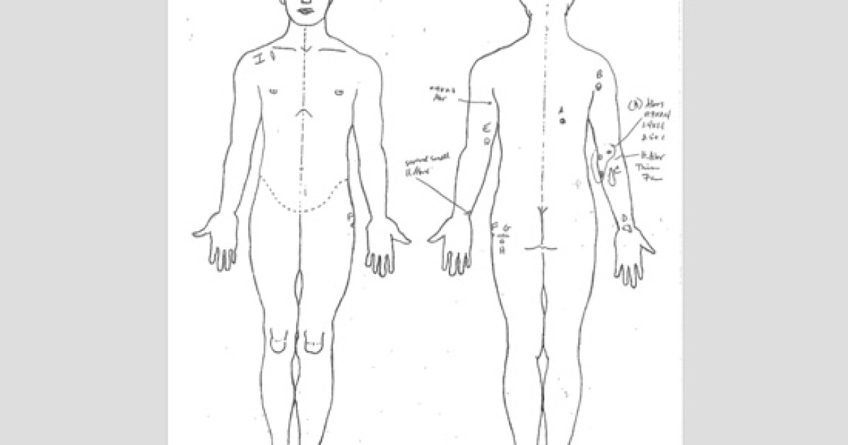 Utah State Medical Examiner Reveals Darrien Hunt Shot Six Times in the Back  | KUER