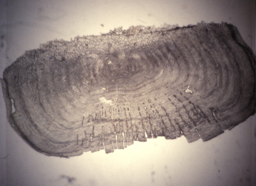A fish otolith, or ear bone, displays annual growth rings that scientists count (much like tree rings) to estimate a fish's age. The shape and size of an otolith vary based on the species.