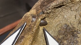 A close-up of the embedded tooth fragment, indicated by the white-paper triangles.