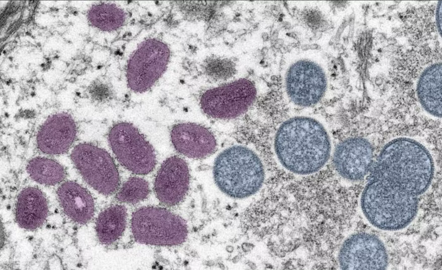  The Monkeypox virus as seen under a microscope