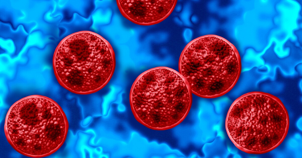 Wisconsin doctor shares what to know about cyclospora