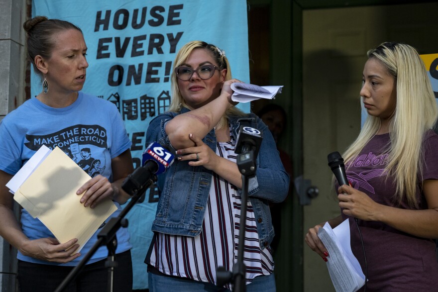 Zamaris Delgado holds her arm, showing an injury she received falling on the apartment's internal stairs which became slippery due to rain leaking in. Tenant union members of a Wethersfield Avenue in Hartford speak out against their current conditions and their landlord's refusal to meet with them and negotiate rental terms.