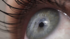 This Thursday, April 12, 2018 photo shows the eye of a woman in New York. (Patrick Sison/AP)