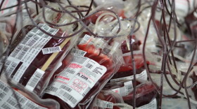 Last week's winter weather lead to shortages at the Kentucky Blood Center, with supplies of less than a day of four blood types.