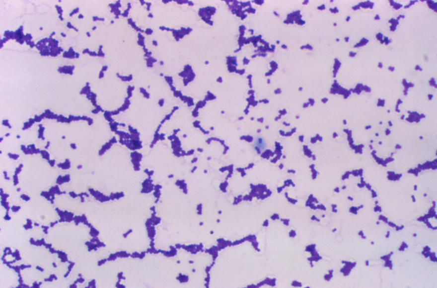 A view of the enterococcus bacteria under a high-powered microscope