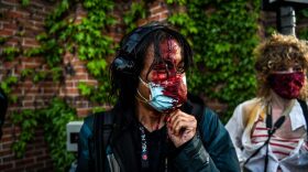 A journalist is seen bleeding after police started firing tear gas and rubber bullets near the 5th police precinct following a demonstration to call for justice for George Floyd, a black man who died while in custody of the Minneapolis police in Minneapolis, Minnesota.