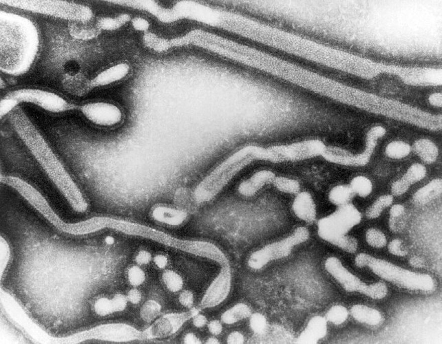 Influenza_A_virus_-_early_passage_TEM_PHIL_279_lores.jpg