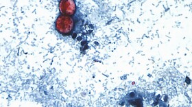 a photo taken through a microscope of Cyclospora cayetanensis oocysts 