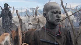 This young herder has lots of protection. The ash on his face isn't just decorative; it keeps away flies. The filter in his pipe removes tiny crustaceans carrying Guinea worm larvae from drinking water.