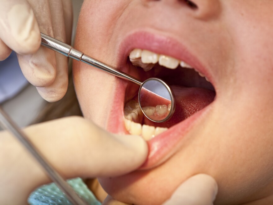 Closeup of a child opening their mouth during a dental exam. A dental mirror is being held in the middle of the open mouth by one gloved hand, while the dentist's other gloved hand can be seen gently holding down the child's upper lip to expose the bottom front teeth. 