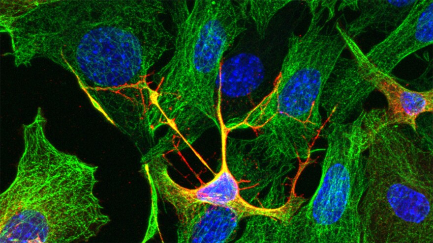 Cells infected with the chikungunya virus project tendrils outwards as a way of infecting neighboring cells. The above image depicts such an infection in mouse embryo cells.