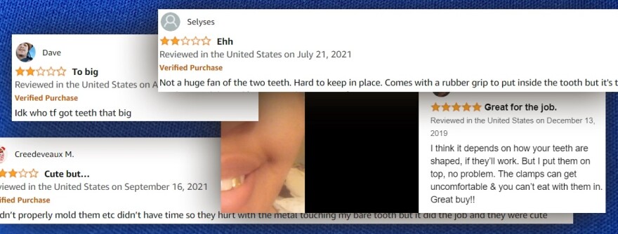  The reviews for the gold-plated, single-tooth grill set were mixed. 