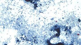 This photomicrograph of a fresh stool sample, which had been prepared using a 10% formalin solution, and stained with safranin, revealed the presence of three uniformly stained Cyclospora cayetanensis oocysts in the field of view.