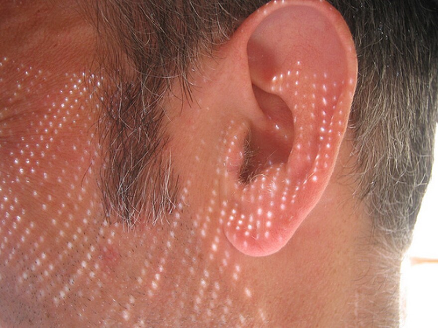 Ear.jpg