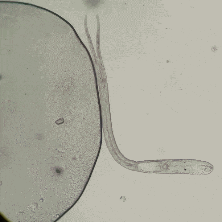 A microscope slide containing Trichobilharzia alaskensis — the tiny parasitic worm known to cause swimmer’s itch in Alaska.