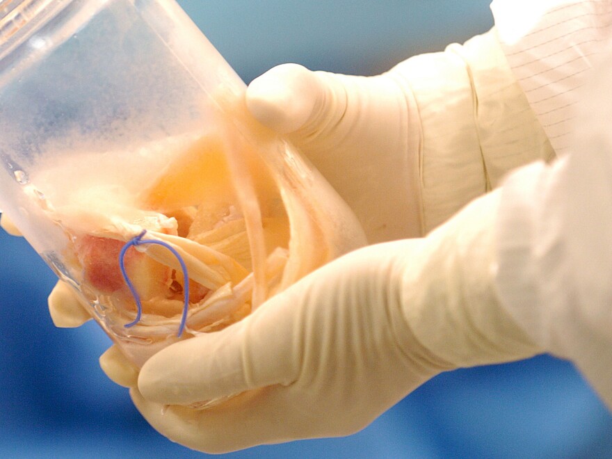 A technician holds a jar containing donated connective tissue.