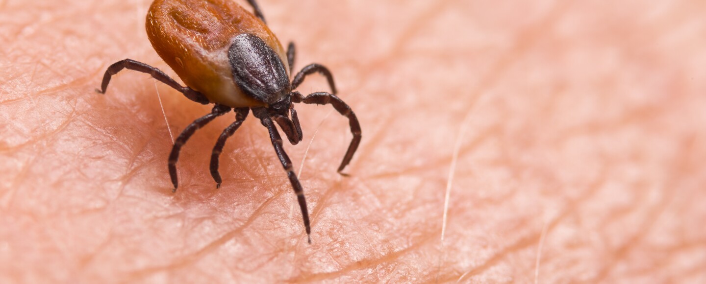 A picture of a brown and black bug on skin