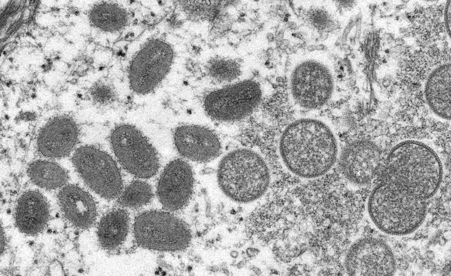  This electron microscopic image depicted a monkeypox virion, obtained from a clinical sample associated with the 2003 prairie dog outbreak. 