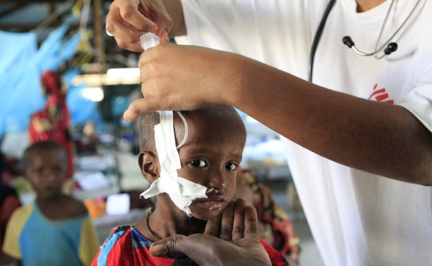 Suldano Osman, 1, is steadied by her mother's hand as a pediatrician attaches a feeding tube to aid her treatment for malnutrition at a Doctors Without Borders hospital in the Dagahaley camp on July 11.
