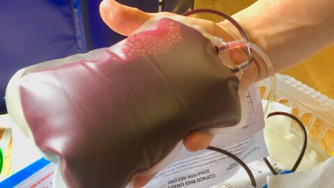 A unit of blood immediately after being donated.