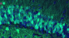 These cells in the hippocampus of our brains help in the transition between short-term and long-term memory