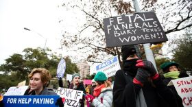 fetal_protest_1_cr_tt-2